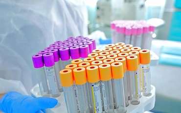ПЦР и тесты на антигены уже не бесплатны с 1 сентября